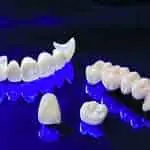 تاج زركونيا