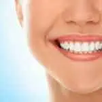 قشور إي ماكس